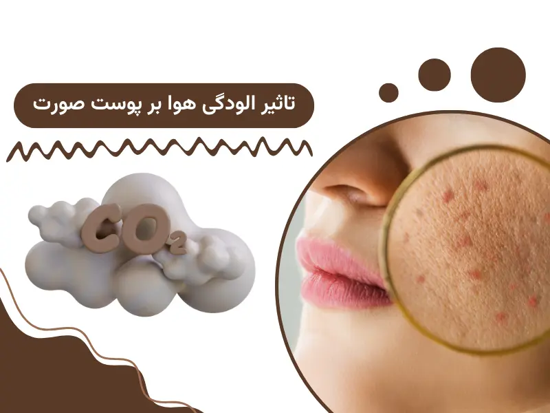 تاثیر الودگی هوا بر پوست صورت