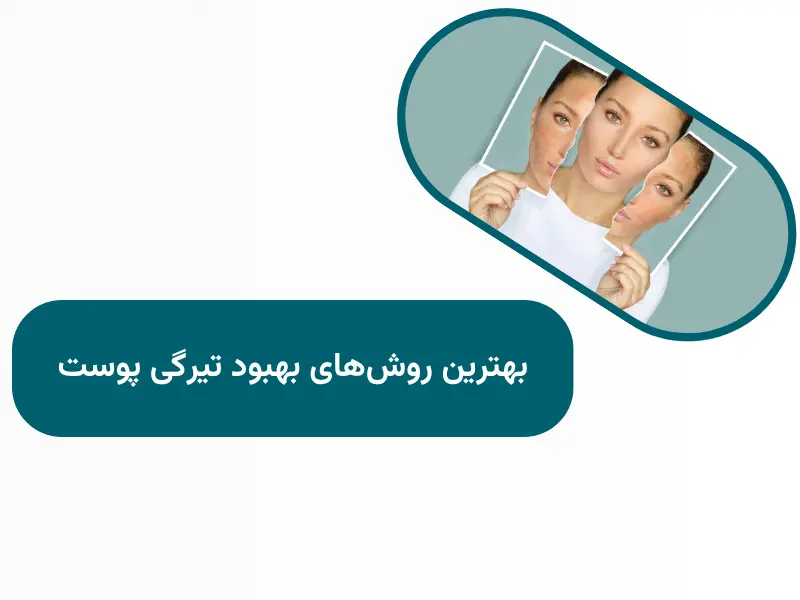 بهترین روش‌های بهبود تیرگی پوست