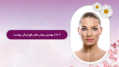 7 تا از بهترین روش های رفع تیرگی پوست