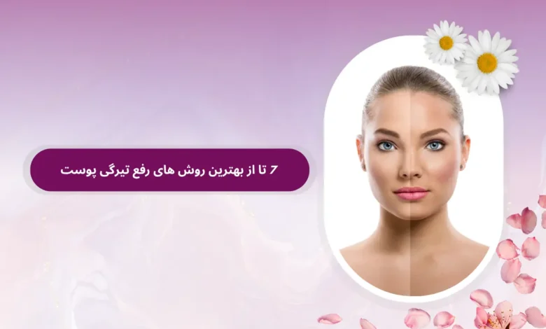 7 تا از بهترین روش های رفع تیرگی پوست